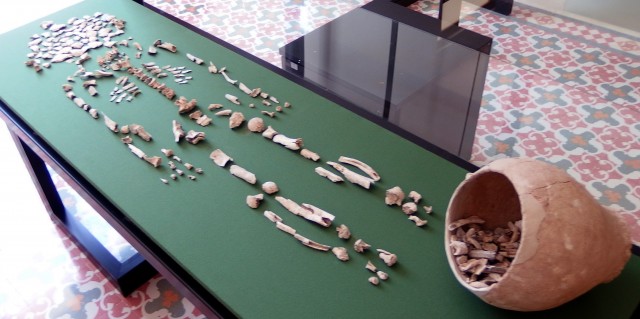 La Casa-Museo del Parc Nou presenta a partir del jueves una exposición de paleopatología